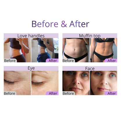 9-in-1 40K Ultrasound Cavitation & RF Machine for Professional Salons