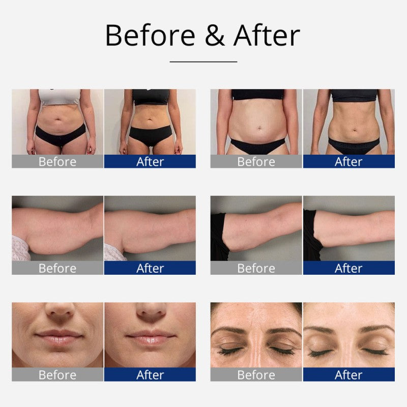 40K Cavitation & RF Body Sculpting Machine for Face and Body