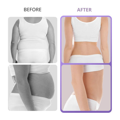 40K Ultrasonic Cavitation Machine for Home or Spa Body Contouring