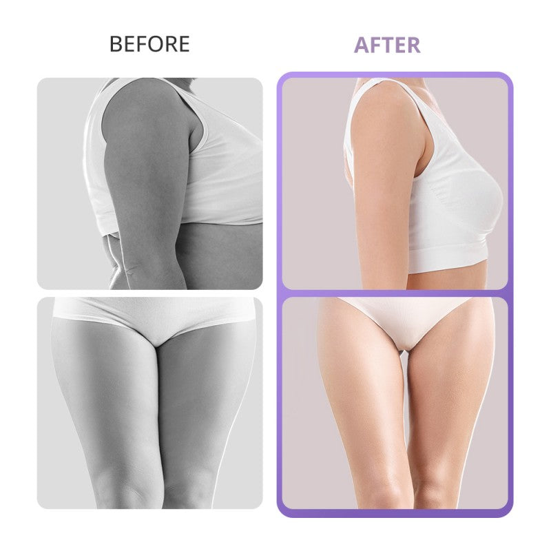 40K Ultrasonic Cavitation Machine for Home or Spa Body Contouring