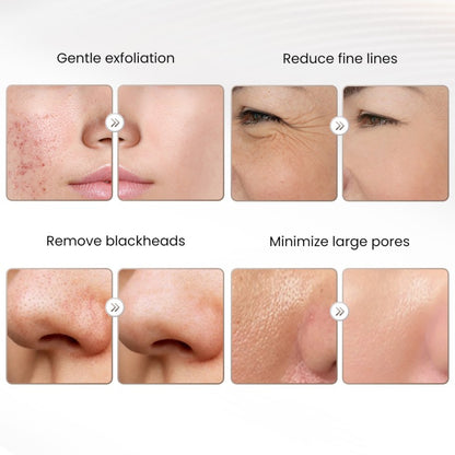 2 in 1 Diamond Microdermabrasion Facial Skin Care Beauty Machine