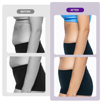 5-in-1 40K Ultrasonic Cavitation & RF Body Contouring Machine