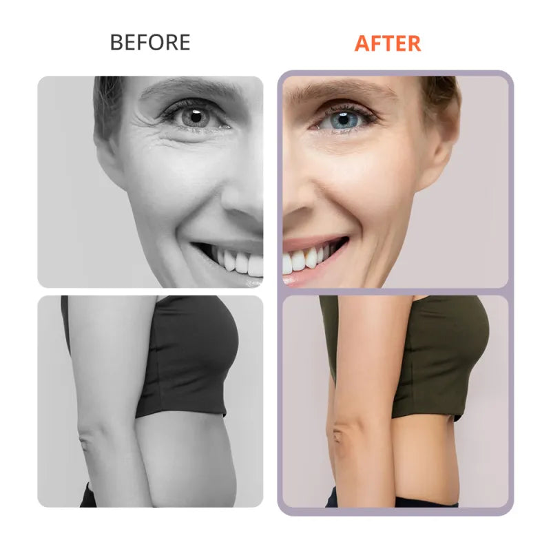 4-in-1 30K S-Shape Cavitation Machine for Body Contouring & Facial Tightening