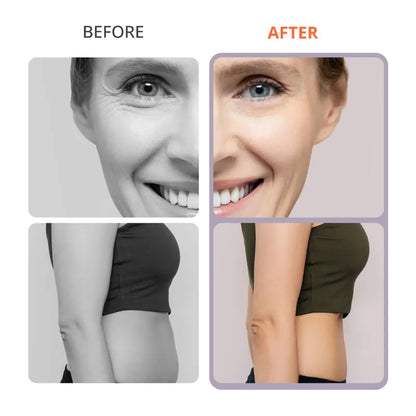 4-in-1 30K S-Shape Cavitation Machine for Body Contouring & Facial Tightening