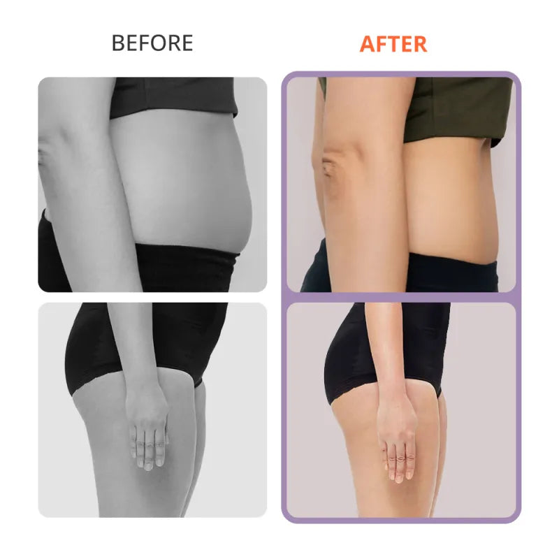 4-in-1 30K S-Shape Cavitation Machine for Body Contouring & Facial Tightening