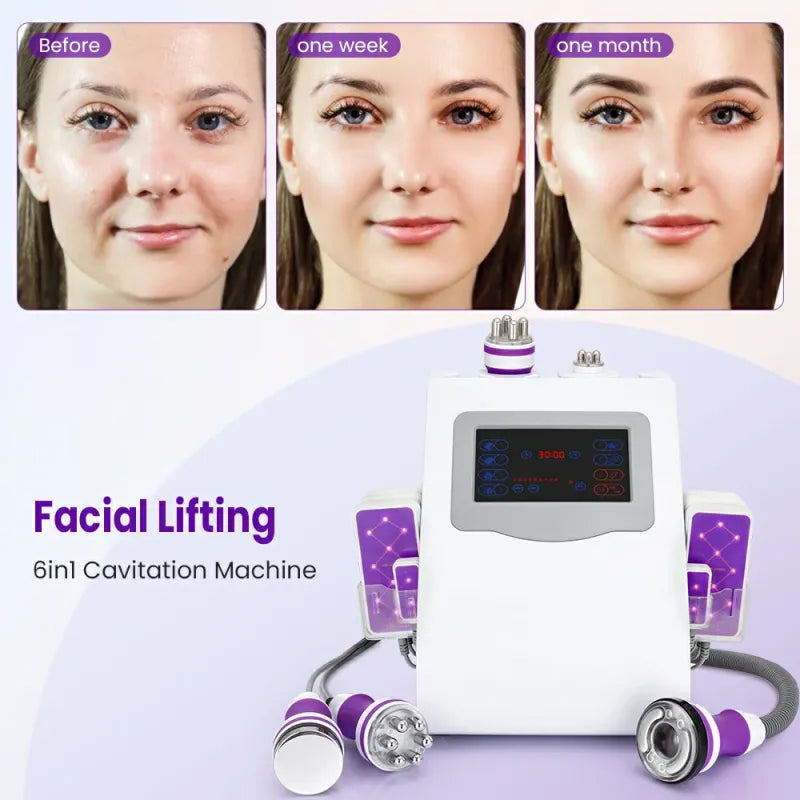 6-in-1 40K Ultrasonic Cavitation Machine for Body & Facial Treatments