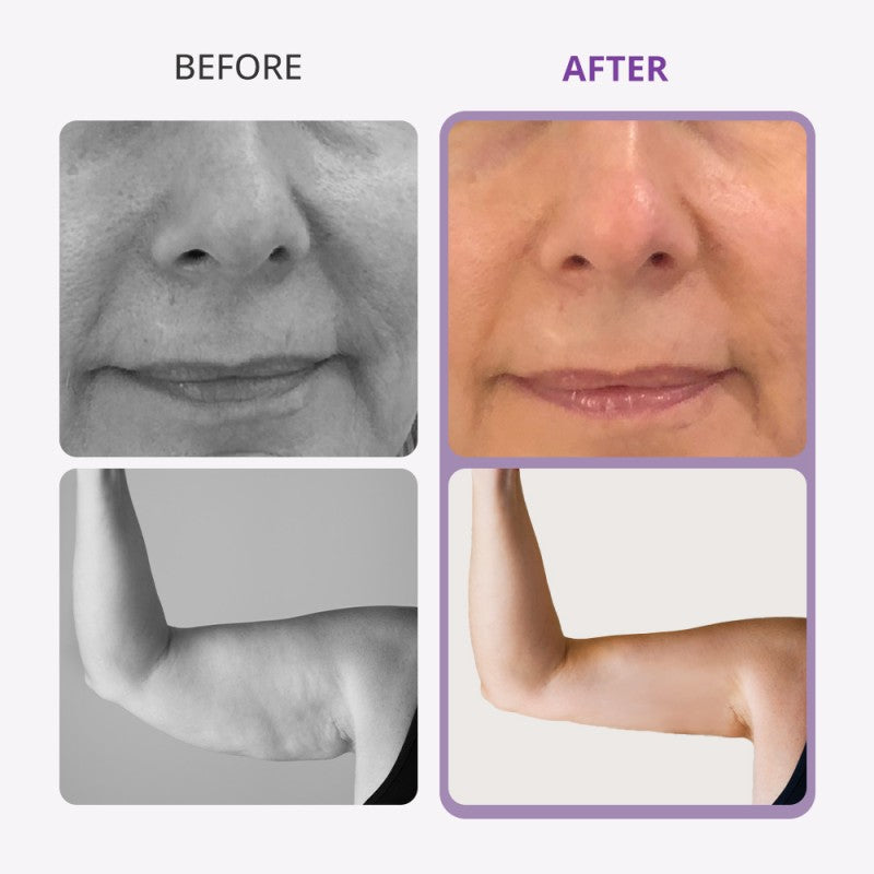 9-in-1 Ultrasonic Cavitation & Lipo Laser Machine for Professional Salons