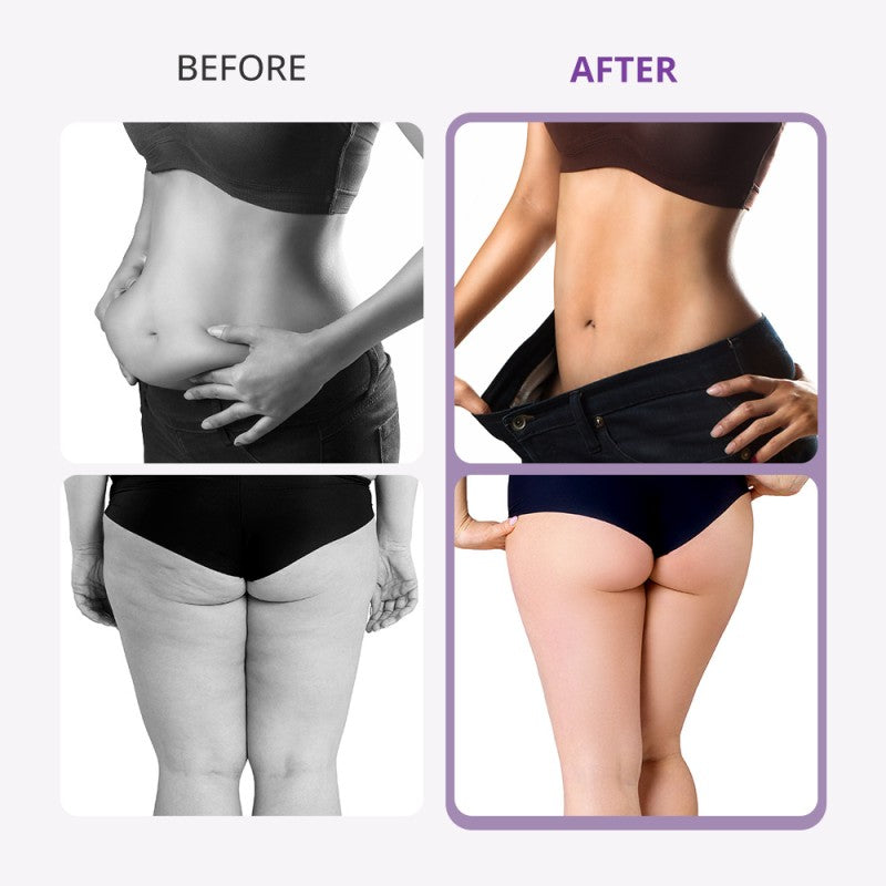 9-in-1 Ultrasonic Cavitation & Lipo Laser Machine for Professional Salons