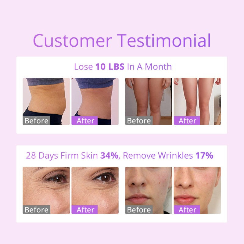 6-in-1 30K S-Shape Cavitation Machine with 5mW Lipo Laser