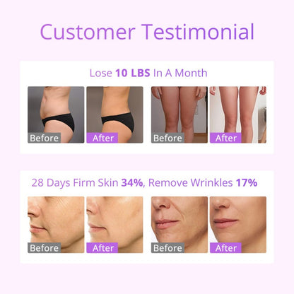 6-in-1 30K S-Shape Cavitation Machine with 160mW Lipo Laser